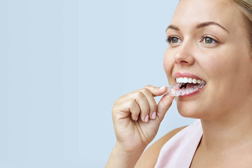3 Reasons to Consider Invisalign or Clear Aligners
